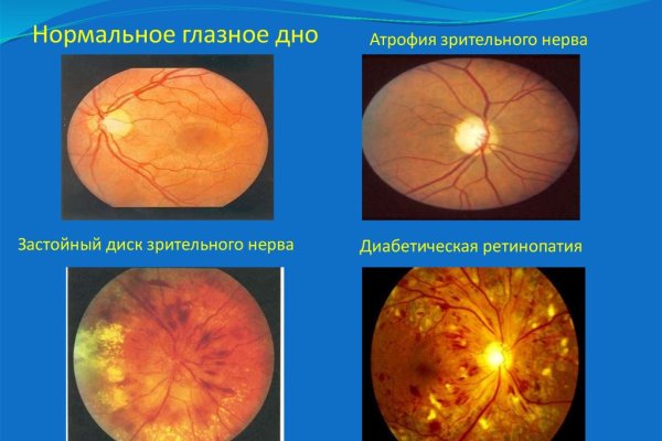 2krn ссылка